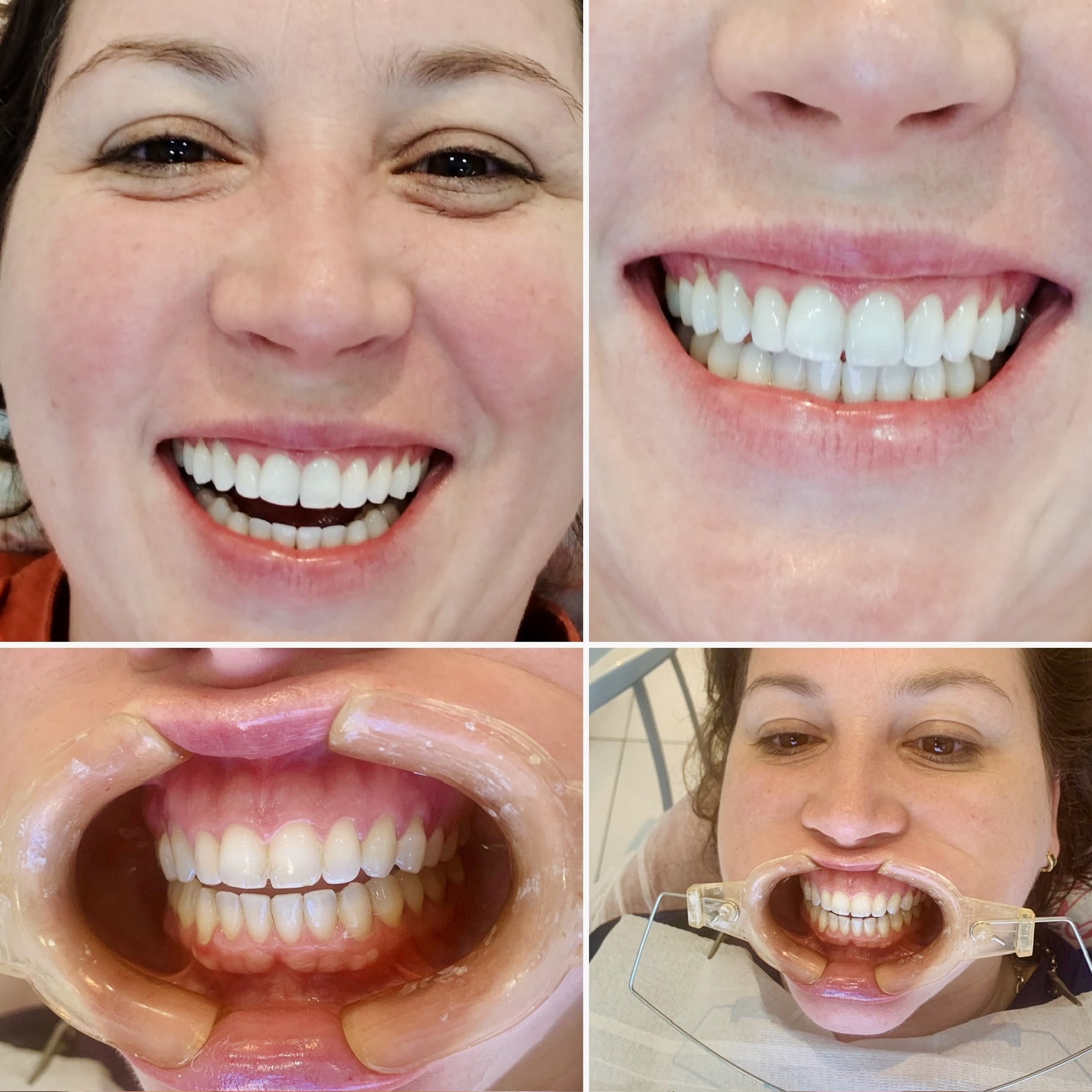 Montagem com quatro fotografias de sorrisos