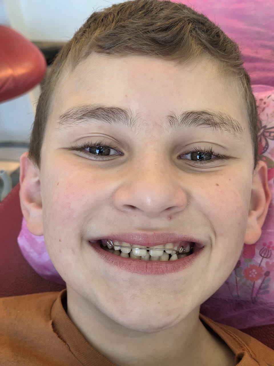 Comparativo de sorriso em duas fotografias
